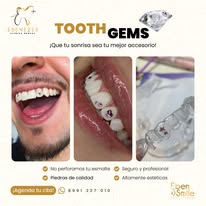 Imagen de ortodoncia